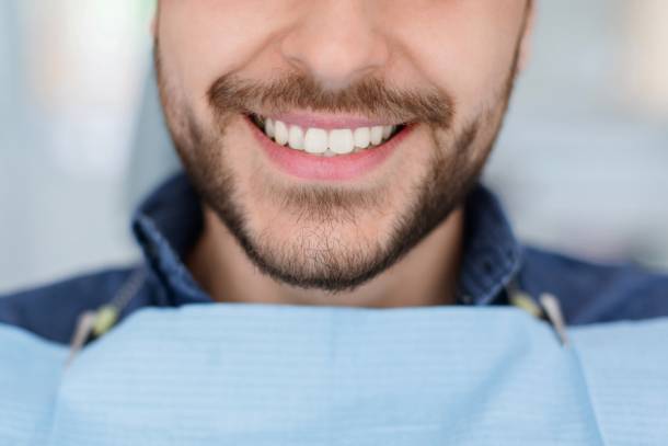blog pulizia dentale