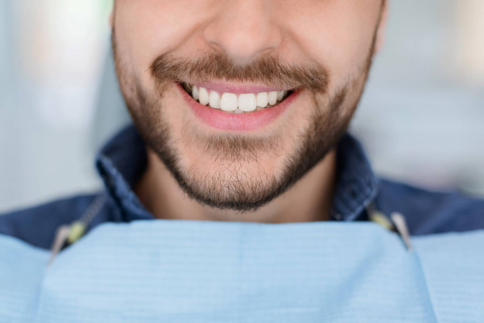 blog pulizia dentale
