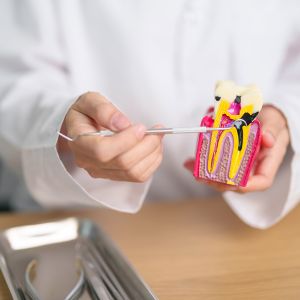 conservativa endodonzia