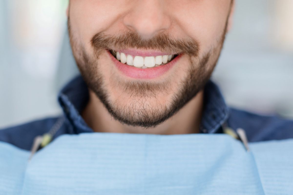 blog pulizia dentale