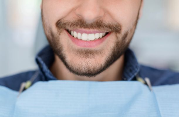 blog pulizia dentale