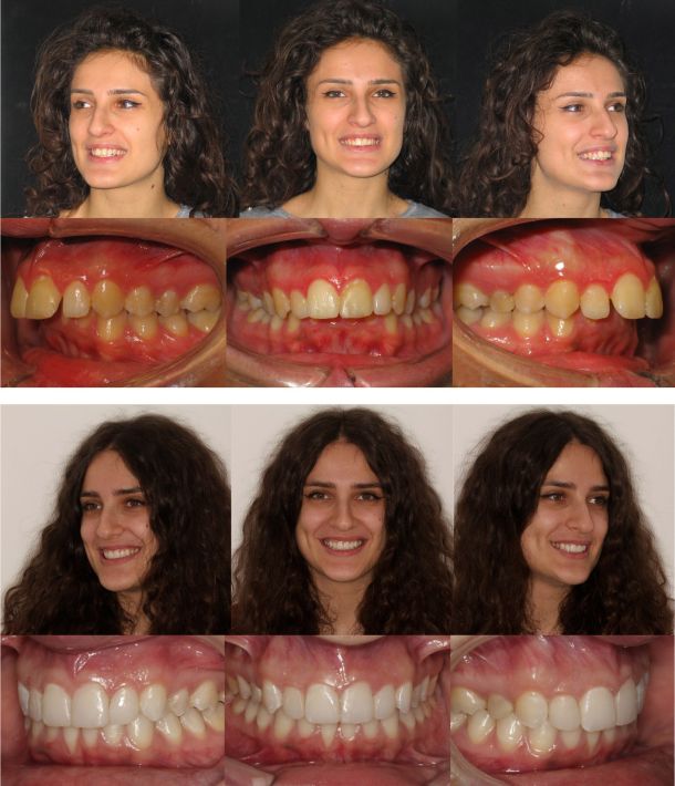 caso clinico rosa new smile